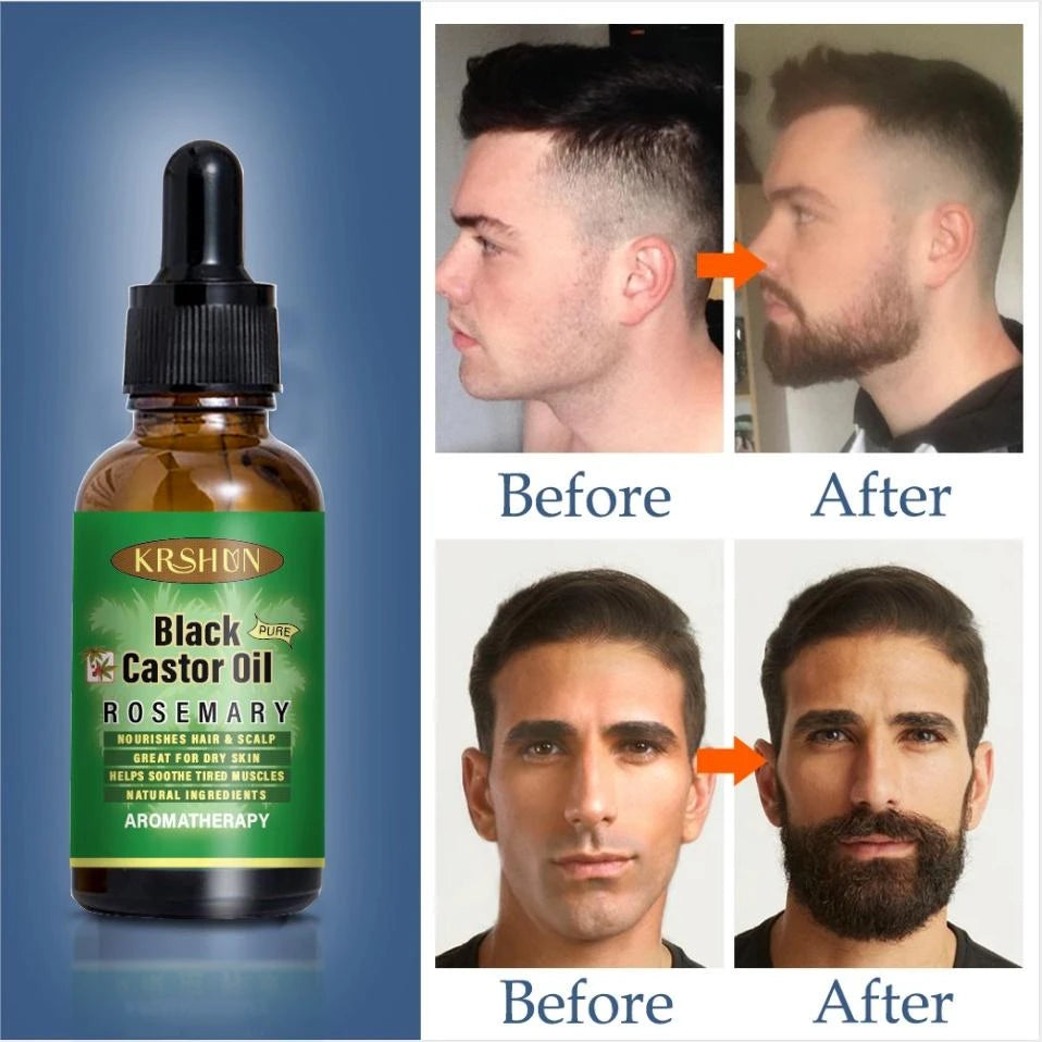 Rosemary Hair Growth Black Castor Oil