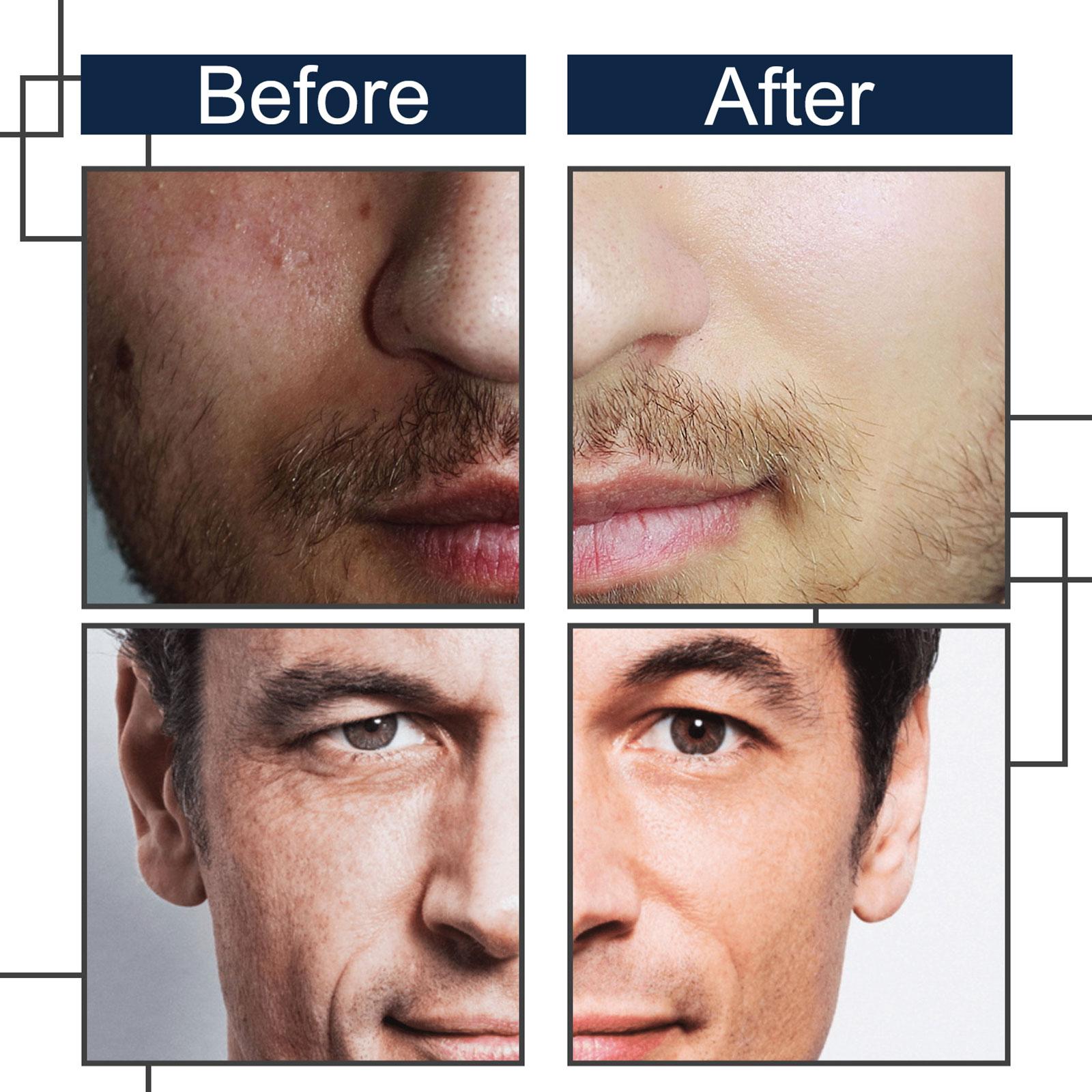 All-In-One Moisturizing Men's Face Cream