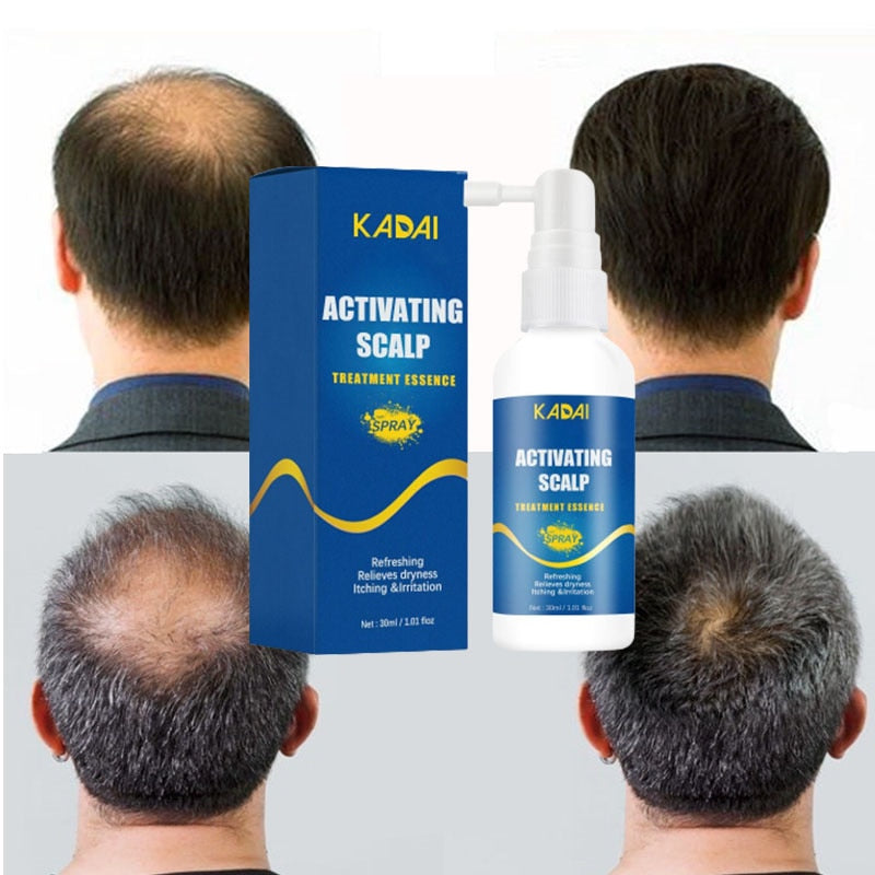 Activating Scalp Hair Regrowth Serum