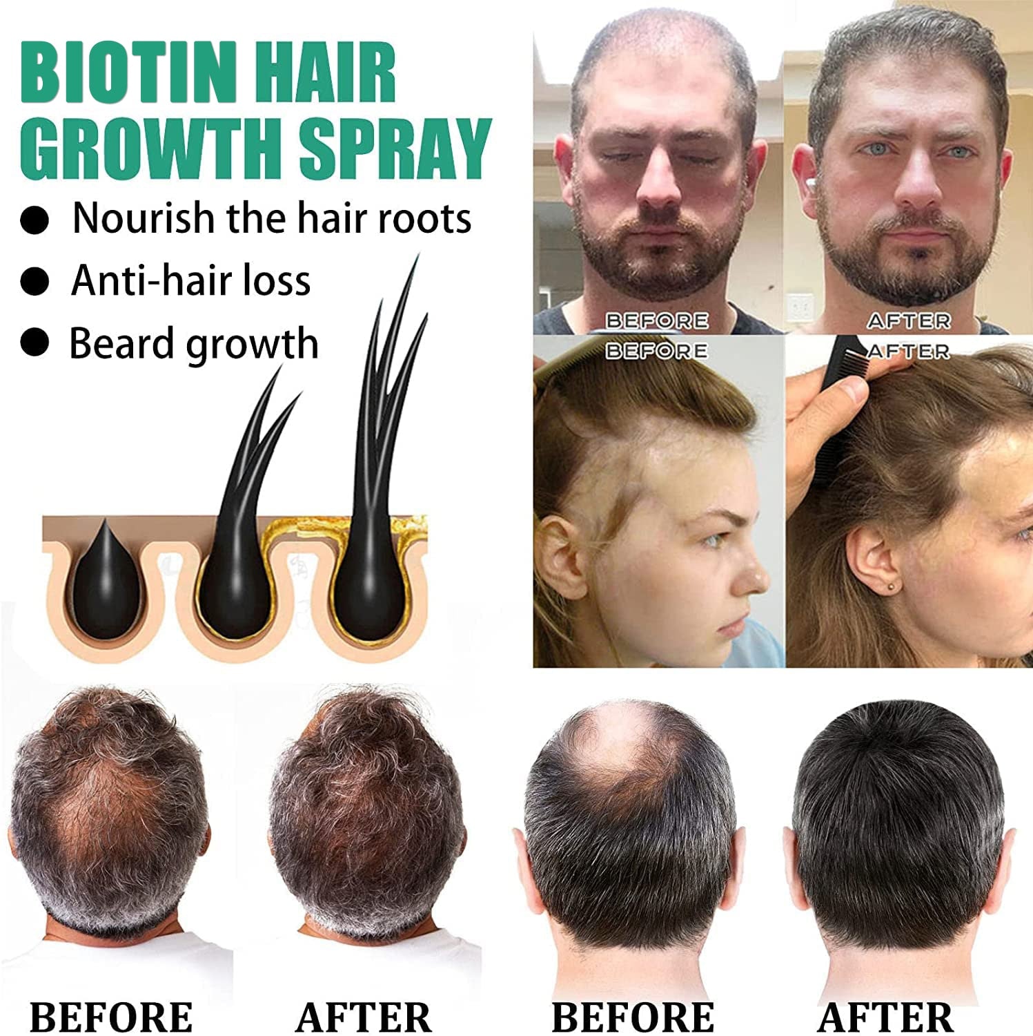 iBeaLee Biotin Hair Growth Serum